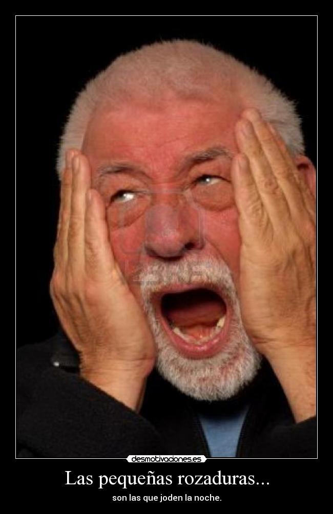Las pequeñas rozaduras... - 