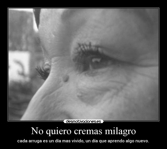 No quiero cremas milagro -