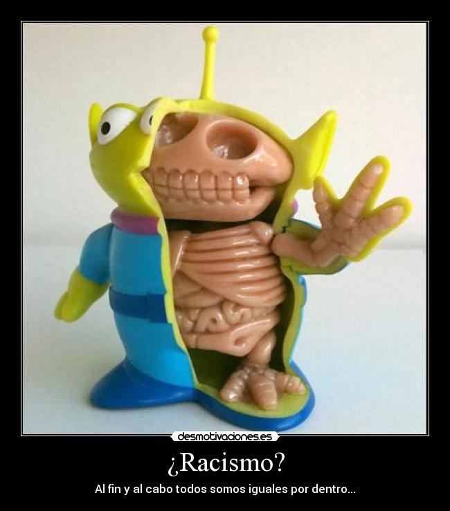 ¿Racismo? -