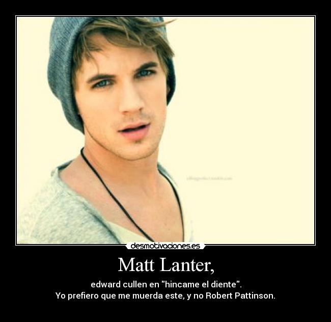 Matt Lanter, - edward cullen en hincame el diente.
Yo prefiero que me muerda este, y no Robert Pattinson.