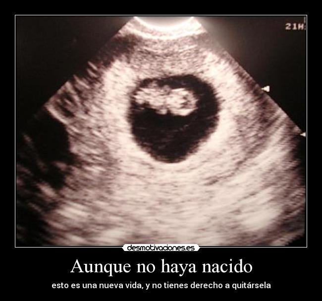Aunque no haya nacido -