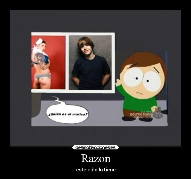 Razon - este niño la tiene