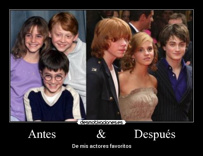 Antes & Después -