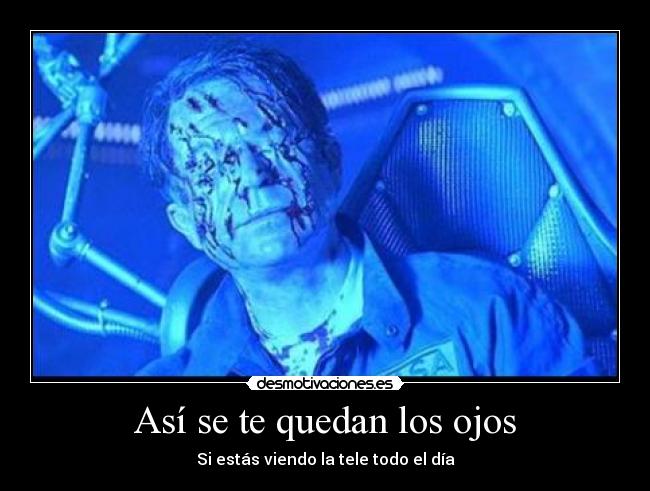 Así se te quedan los ojos - Si estás viendo la tele todo el día