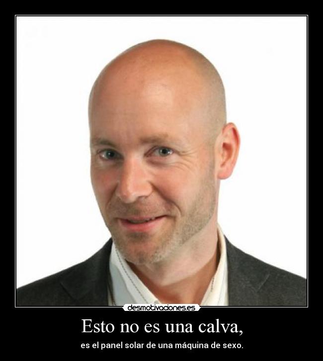 Esto no es una calva, -