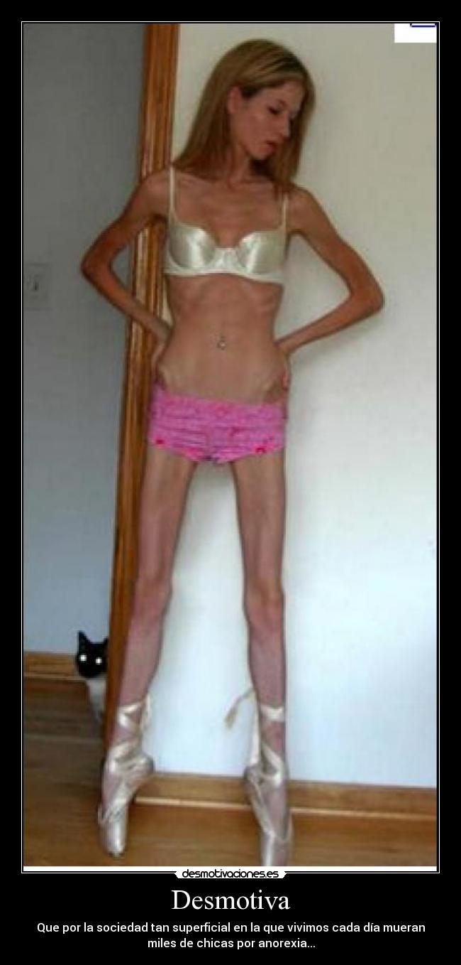 Desmotiva - Que por la sociedad tan superficial en la que vivimos cada día mueran
miles de chicas por anorexia...