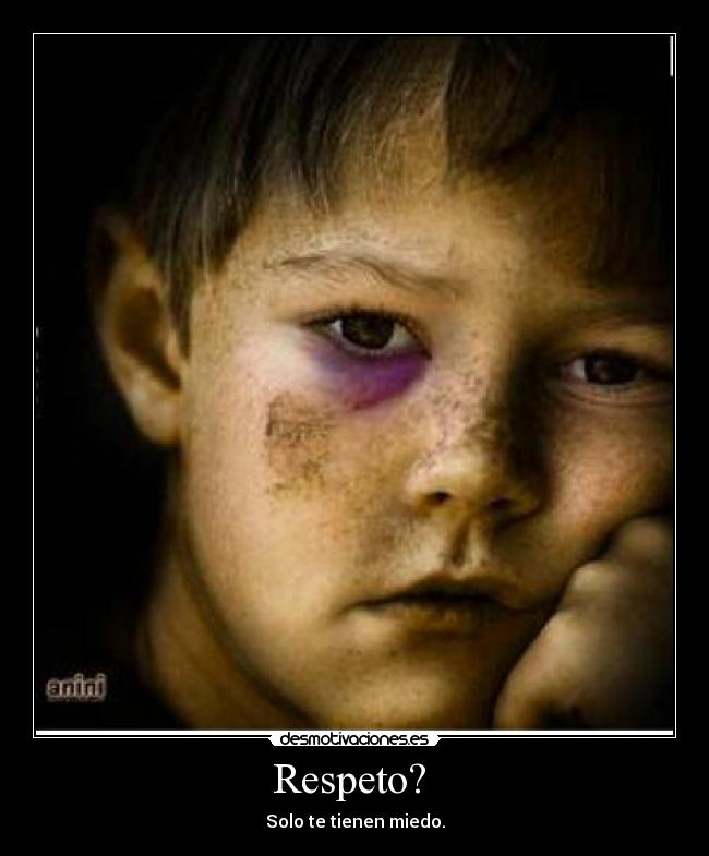 Respeto?  - Solo te tienen miedo.