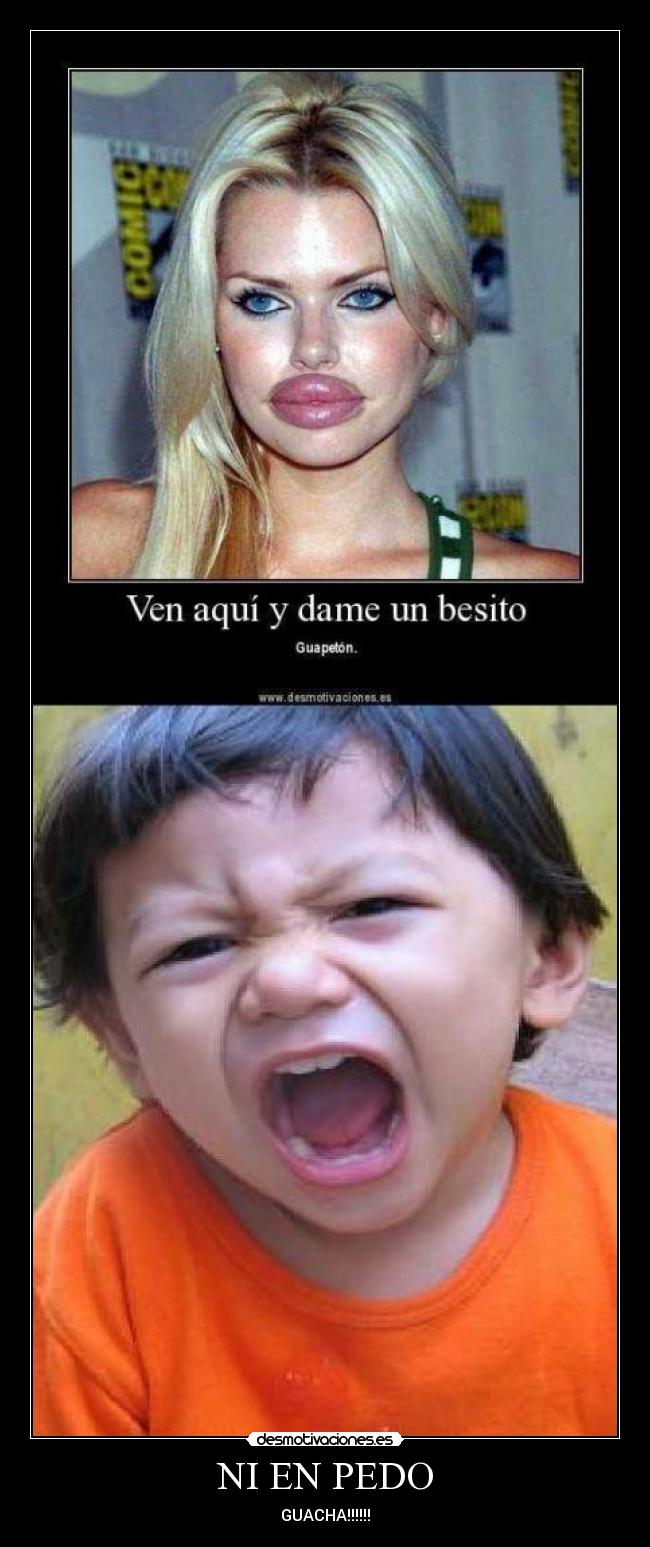 NI EN PEDO - GUACHA!!!!!!