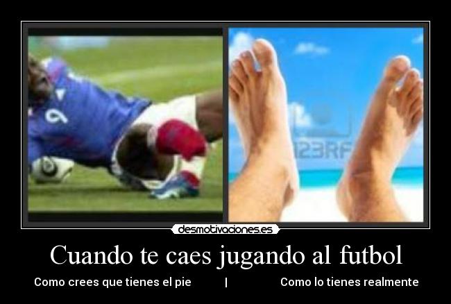 Cuando te caes jugando al futbol - 
