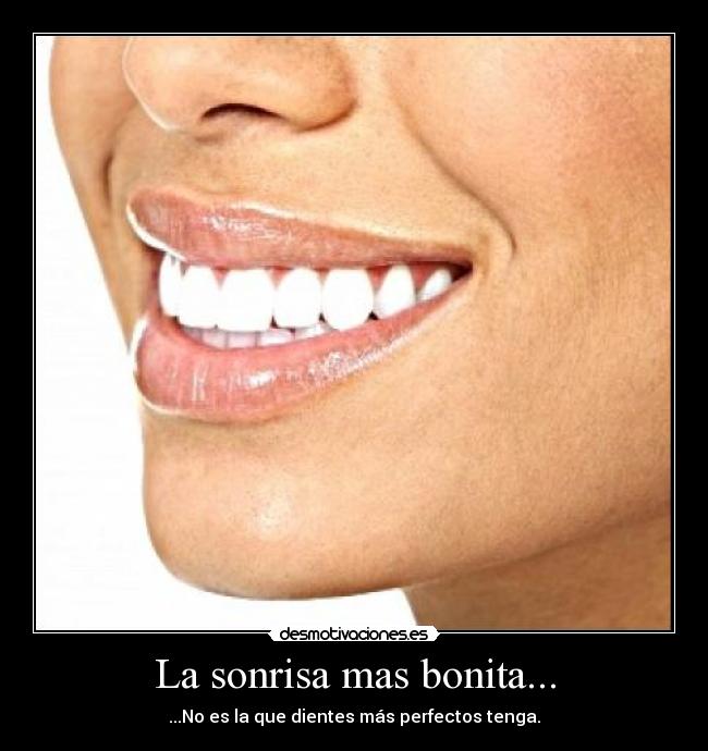 La sonrisa mas bonita... - ...No es la que dientes más perfectos tenga.