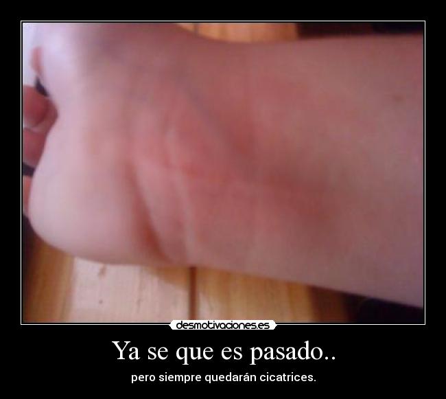 carteles pasado cicatrices del pasado desmotivaciones