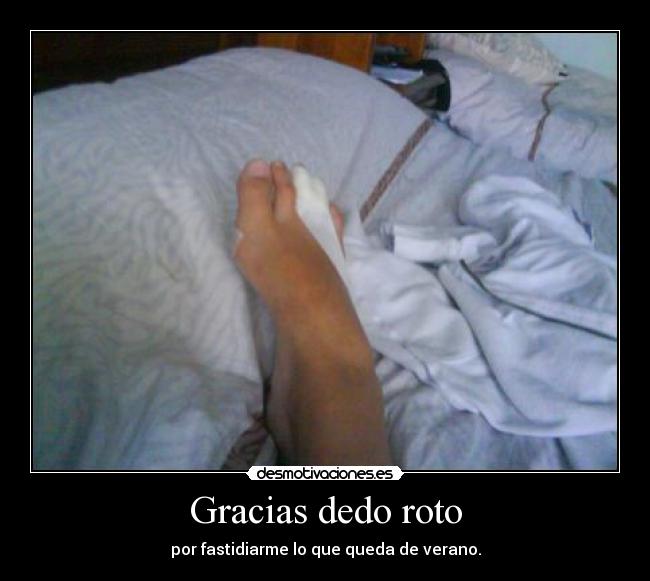 Gracias dedo roto - 