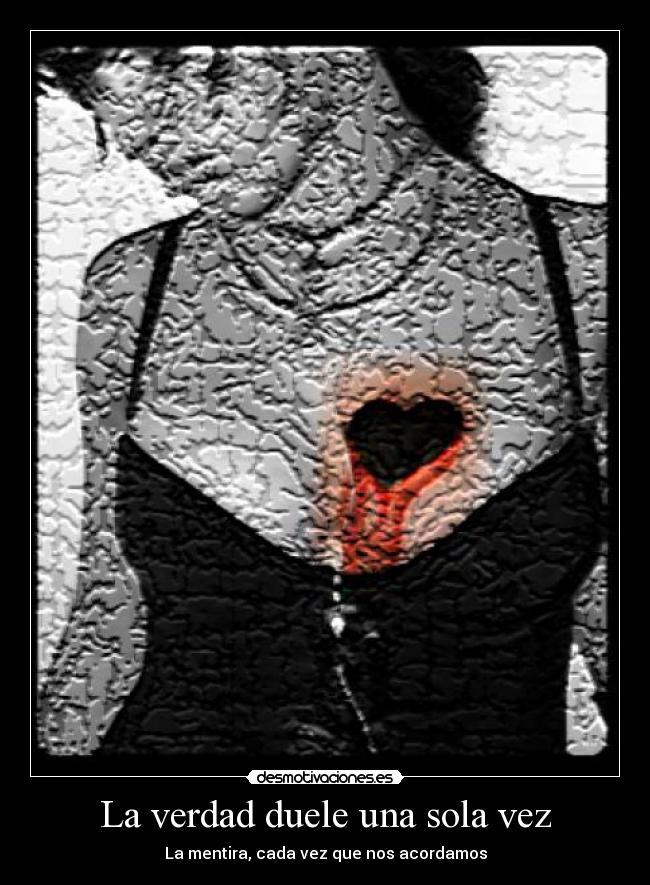 La verdad duele una sola vez -