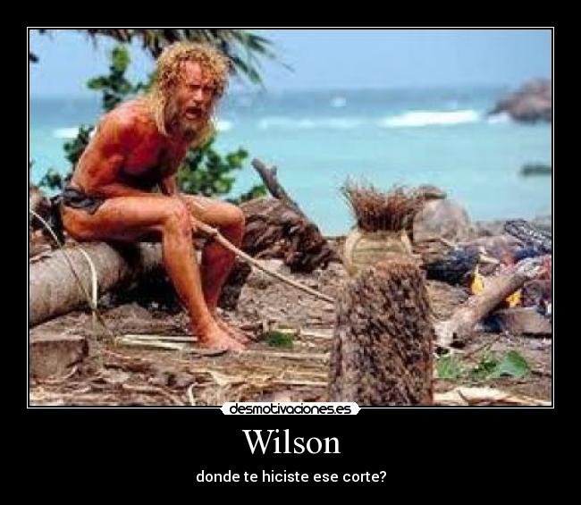 Wilson - donde te hiciste ese corte?