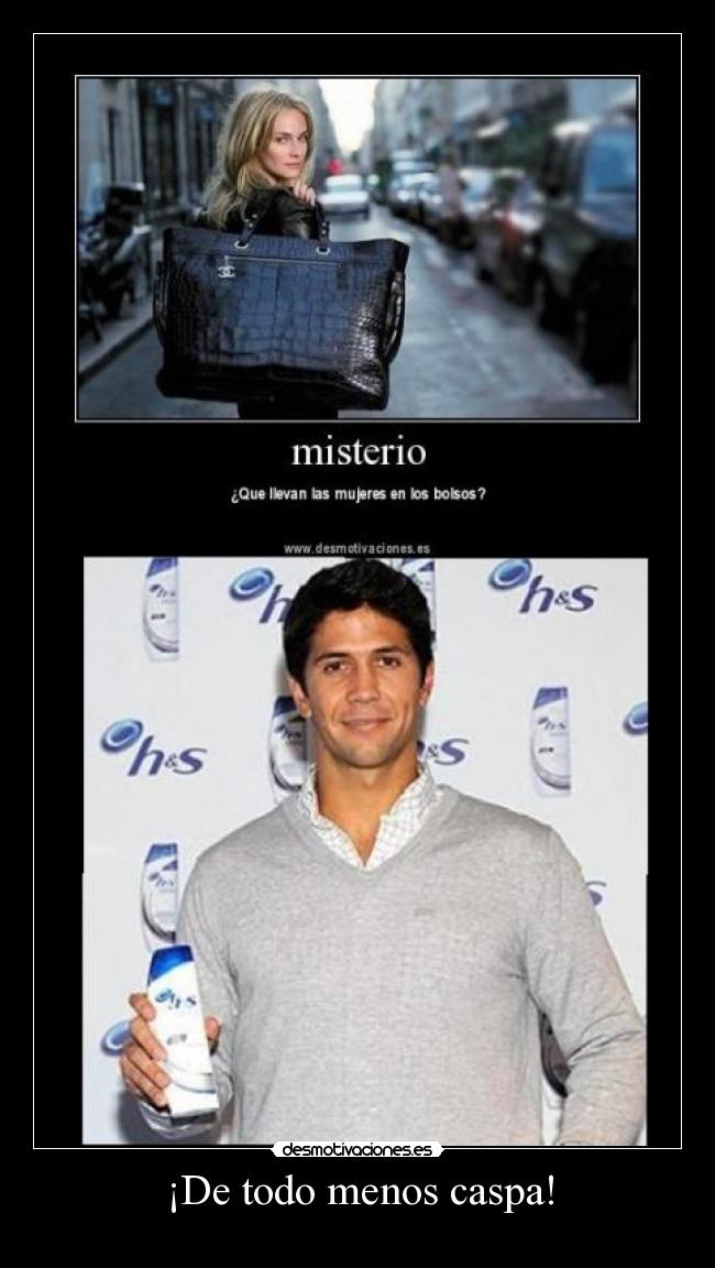 ¡De todo menos caspa! - 