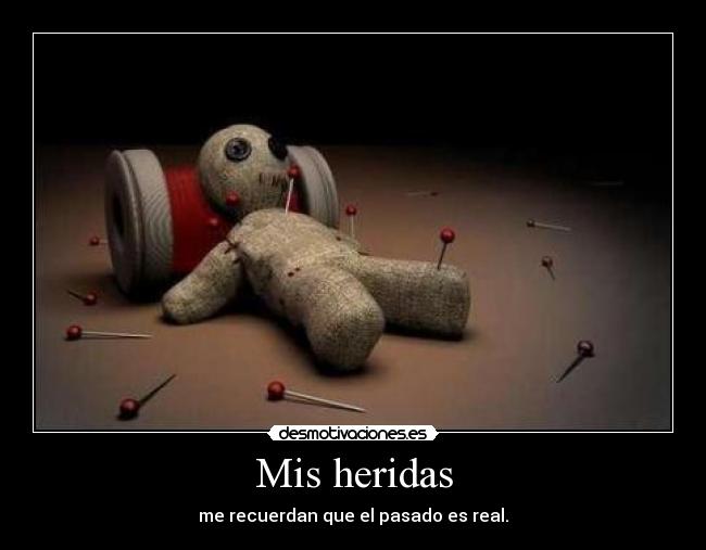 Mis heridas - me recuerdan que el pasado es real.