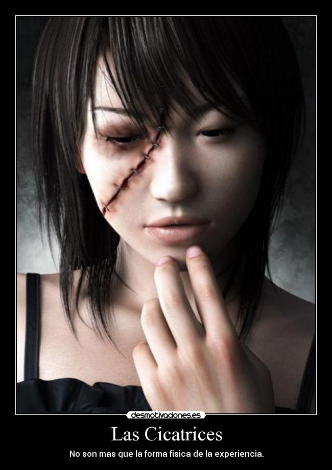 Las Cicatrices -