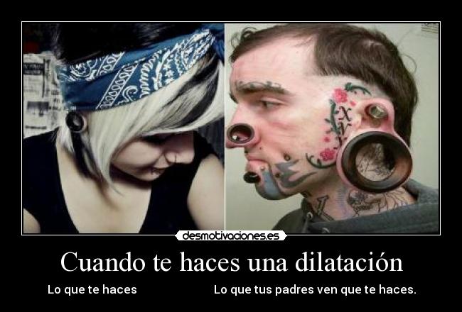 Cuando te haces una dilatación -