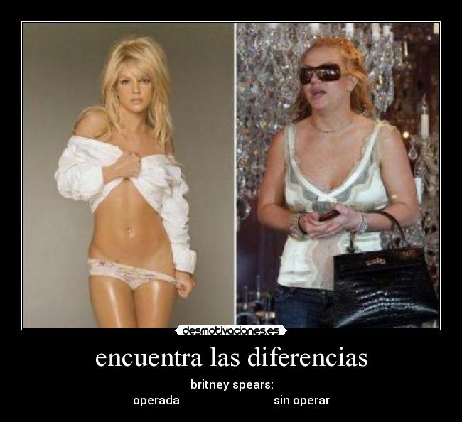 encuentra las diferencias - britney spears:
operada sin operar