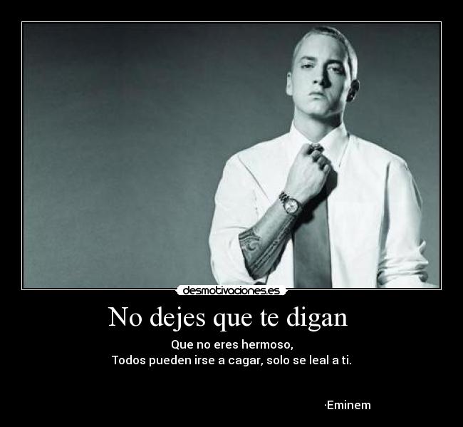 No dejes que te digan - Que no eres hermoso,
Todos pueden irse a cagar, solo se leal a ti.
·Eminem