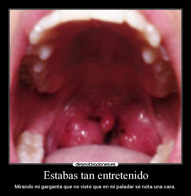 Estabas tan entretenido - Mirando mi garganta que no viste que en mi paladar se nota una cara.