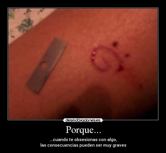 Porque... -