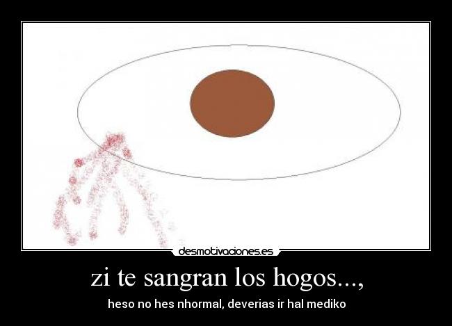 zi te sangran los hogos..., - heso no hes nhormal, deverias ir hal mediko