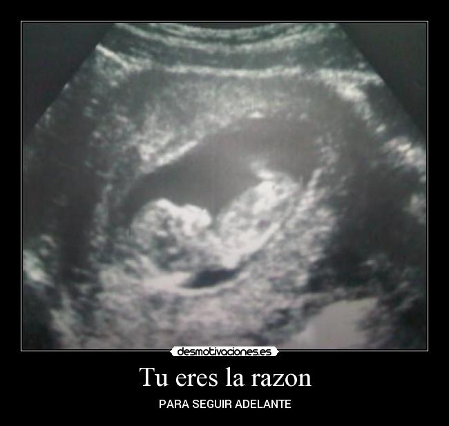 Tu eres la razon -
