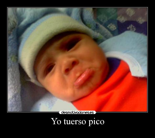 Yo tuerso pico -