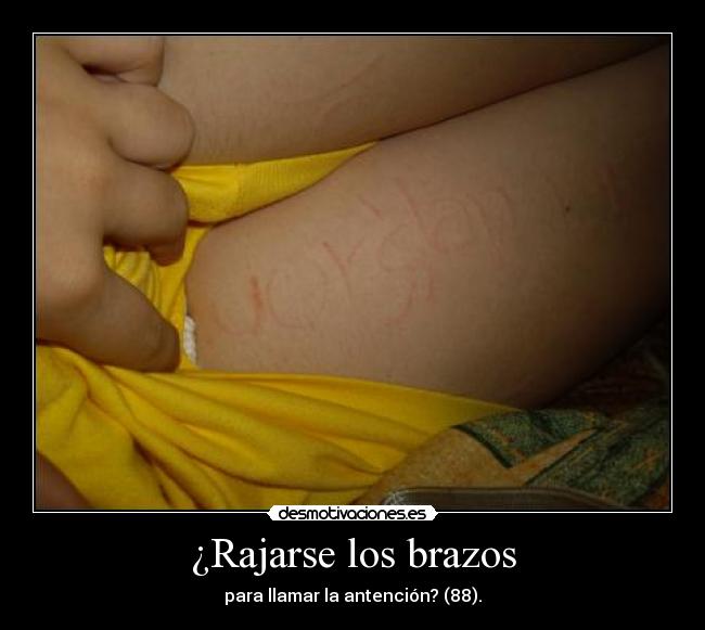 ¿Rajarse los brazos - 