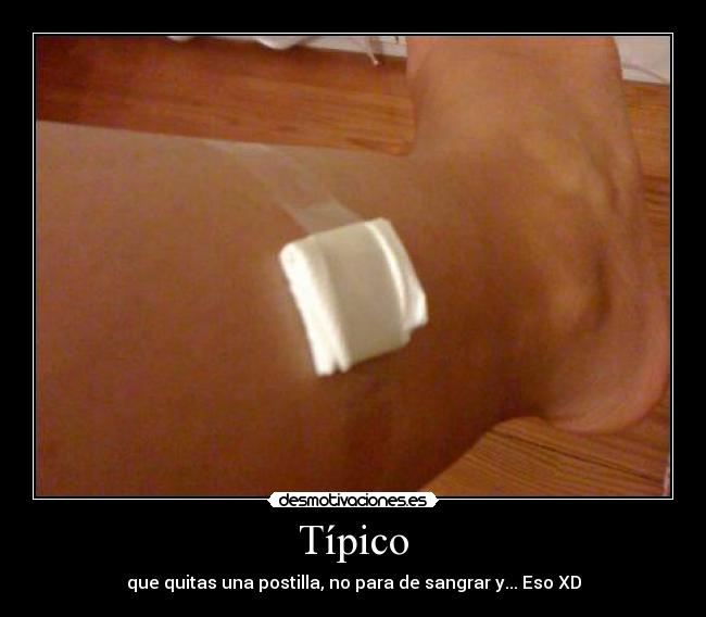 Típico - que quitas una postilla, no para de sangrar y... Eso XD
