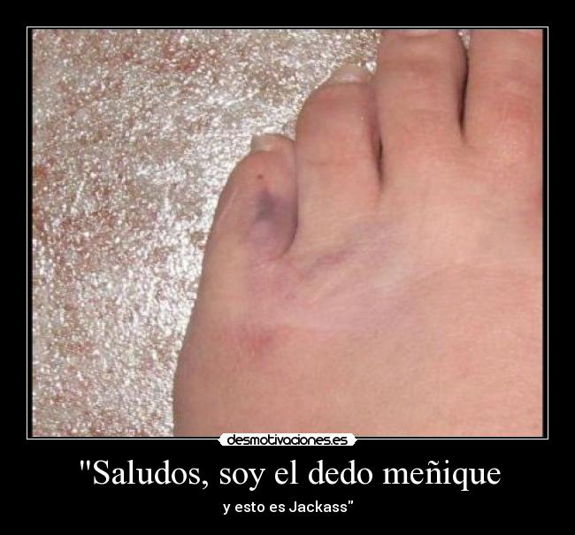 Saludos, soy el dedo meñique - y esto es Jackass