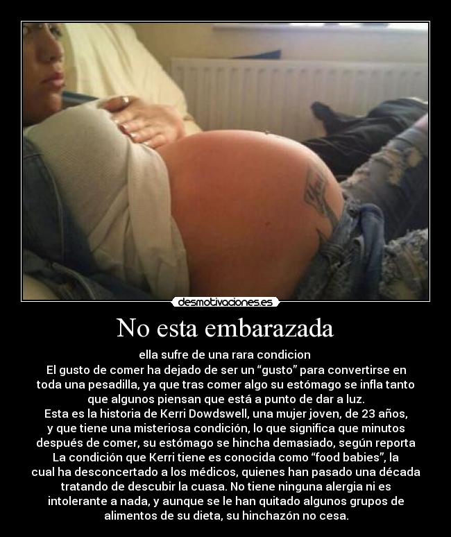 No esta embarazada - ella sufre de una rara condicion 
El gusto de comer ha dejado de ser un “gusto” para convertirse en
toda una pesadilla, ya que tras comer algo su estómago se infla tanto
que algunos piensan que está a punto de dar a luz.
Esta es la historia de Kerri Dowdswell, una mujer joven, de 23 años,
y que tiene una misteriosa condición, lo que significa que minutos
después de comer, su estómago se hincha demasiado, según reporta
La condición que Kerri tiene es conocida como “food babies”, la
cual ha desconcertado a los médicos, quienes han pasado una década
tratando de descubir la cuasa. No tiene ninguna alergia ni es
intolerante a nada, y aunque se le han quitado algunos grupos de
alimentos de su dieta, su hinchazón no cesa.