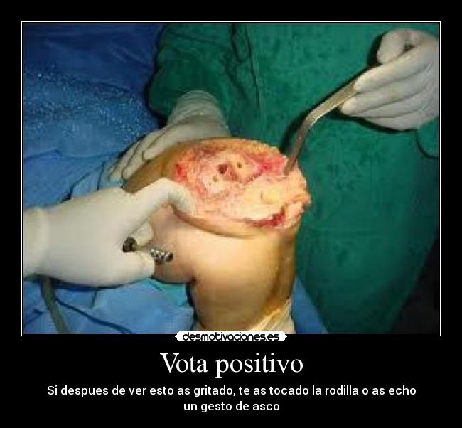 Vota positivo - 