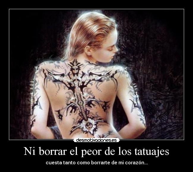 Ni borrar el peor de los tatuajes -