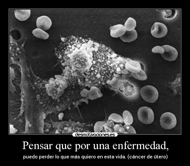 Pensar que por una enfermedad, - 