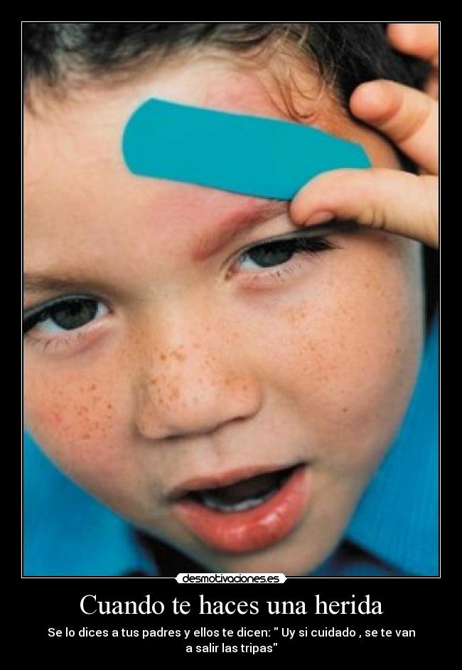 Cuando te haces una herida - Se lo dices a tus padres y ellos te dicen:  Uy si cuidado , se te van a salir las tripas