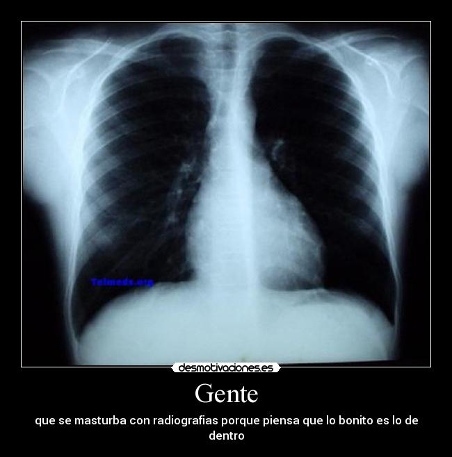 Gente - que se masturba con radiografias porque piensa que lo bonito es lo de dentro