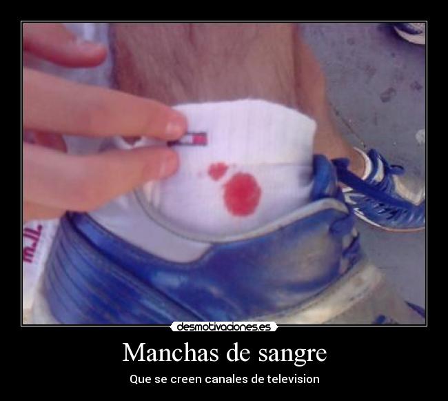 Manchas de sangre -