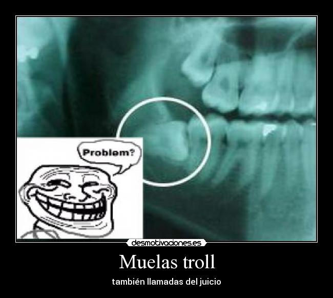 Muelas troll -
