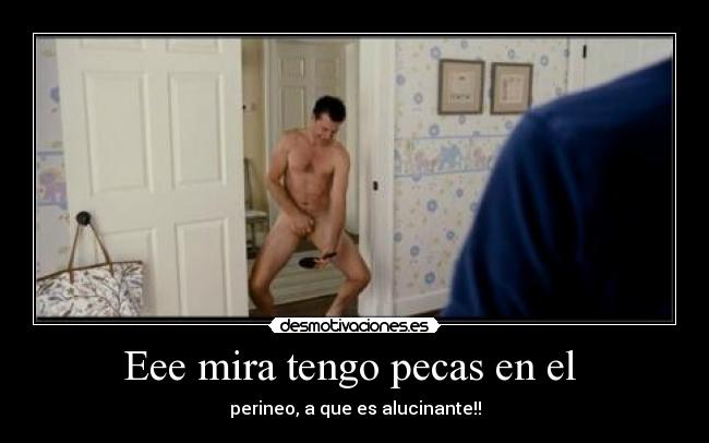 Eee mira tengo pecas en el  - perineo, a que es alucinante!!