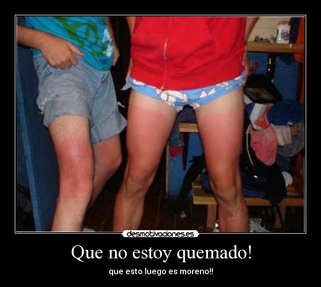 Que no estoy quemado! - que esto luego es moreno!!
