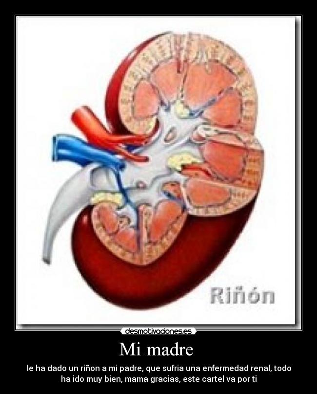 Mi madre - le ha dado un riñon a mi padre, que sufria una enfermedad renal, todo
ha ido muy bien, mama gracias, este cartel va por ti♥