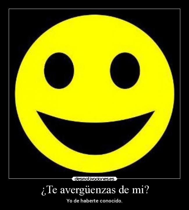 ¿Te avergüenzas de mi? -