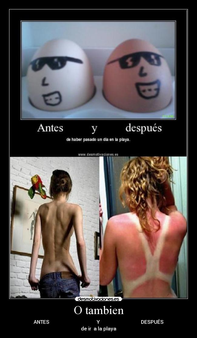 O tambien - ANTES Y DESPUÉS
de ir a la playa