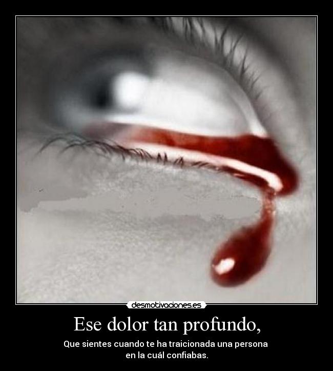 Ese dolor tan profundo, -