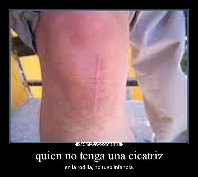 carteles rodilla cicatriz desmotivaciones