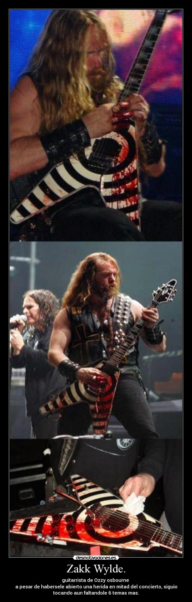 Zakk Wylde. - guitarrista de Ozzy osbourne
a pesar de habersele abierto una herida en mitad del concierto, siguio
tocando aun faltandole 6 temas mas.