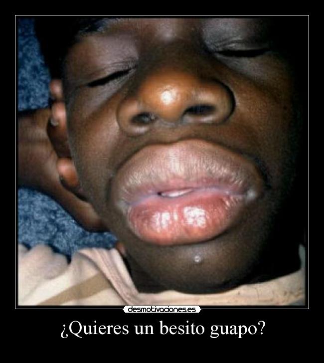 ¿Quieres un besito guapo? -