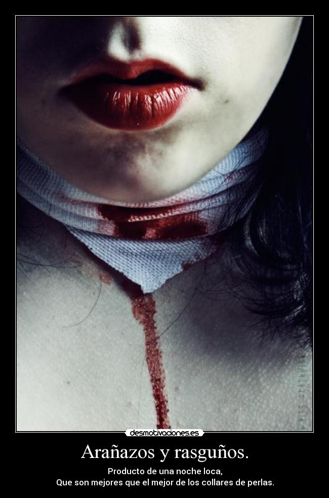 Arañazos y rasguños. -